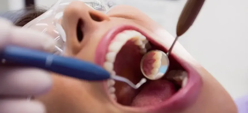 Restauração dental estética em Contagem — OdontoFull